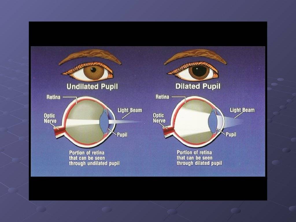 Самые эффективные капли для глаз после сварки